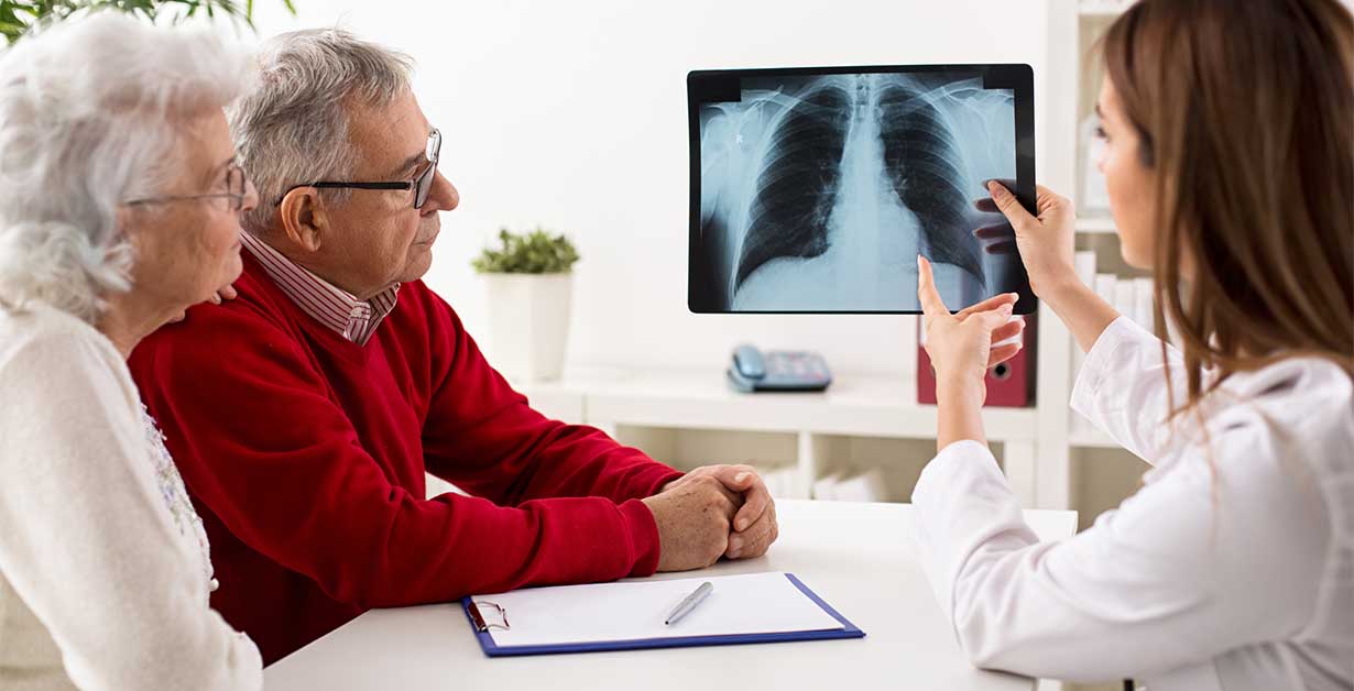 lung cancer treatment