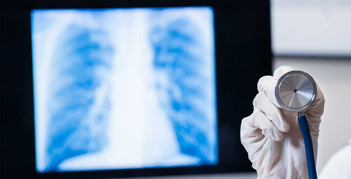 A stethoscope being held up in front of a lung scan.