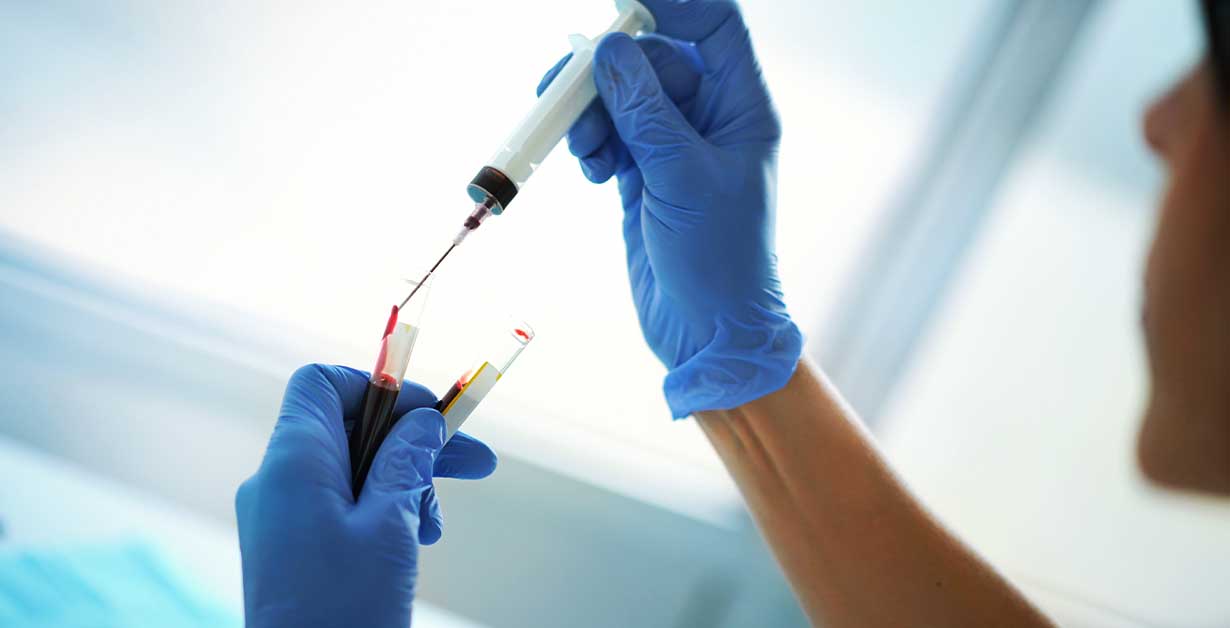A doctor putting blood into a glass tube.